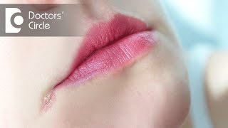 How to manage Angular Cheilitis  Dr Aniruddha KB [upl. by Adigun]