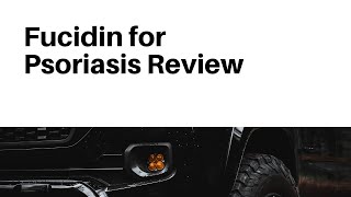 Fucidin for Psoriasis Review [upl. by Ddat187]