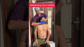 The Expert Treatment to Ankylosing spondylitis PTAnindya [upl. by Lewej]