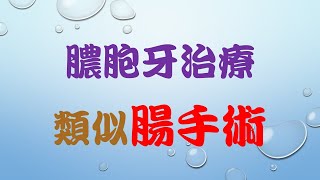 【膿包牙案例】膿包牙治療類似腸手術 [upl. by Sileray]