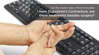 Treatment Options for Dupuytrens Contracture [upl. by Esirehc]