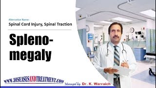 Spleenomegaly Enlarged Spleen  Causes Diagnosis Symptoms Treatment Prognosis [upl. by Riabuz]