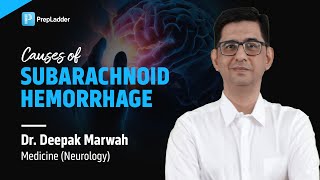 Causes of Subarachnoid Hemorrhage by Dr Deepak Marwah [upl. by Benildis443]