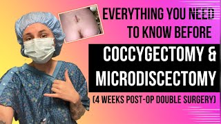 EVERYTHING YOU NEED TO KNOW  Double Surgery Coccygectomy amp Microdiscectomy  4 Weeks PostOp [upl. by Eixam]