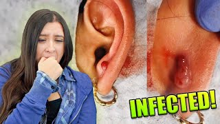 Reacting To INFECTED Ear Lobe Piercing [upl. by Akcirred]