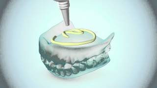 Crème fixative dentaire révolutionnaire avec 24h de tenue pour prothèse supérieure [upl. by Remle]