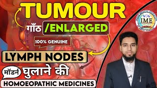 Enlarged lymph nodesCausesTreatment गिल्टि धुलाने वाली दवा  Tumour homoeopathic medicine [upl. by Tolman]