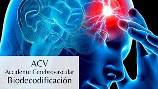 ACV  Accidente Cerebrovascular [upl. by Htir352]