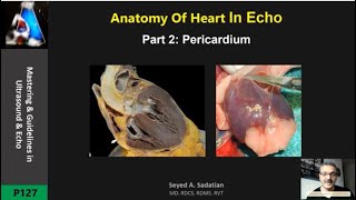 anatomy of Heart in Echo Part 2 Pericardium [upl. by Philippe]