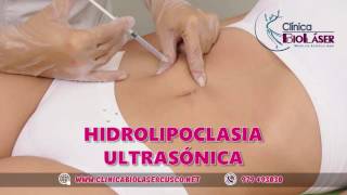 HIDROLIPOCLASIA ULTRASONICA EN CUSCO [upl. by Argyres]