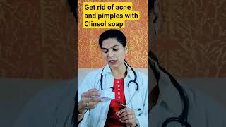 Get rid of acne and pimples with Clinsol soap shorts [upl. by Collen]