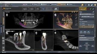 Sidexis 4 and Sicat Suite tutorial [upl. by Irelav672]