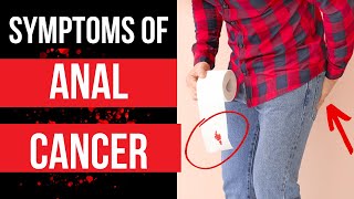 Doctor explains SYMPTOMS OF ANAL CANCER  plus risk factors diagnosis and treatment [upl. by Erasme]