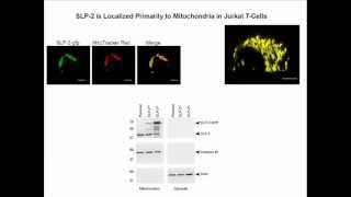 Linking cardiolipin remodeling to mitochondrial betaoxidation [upl. by Nomzzaj]