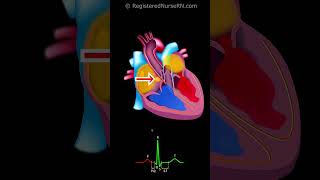 Cardiac Conduction System Electrical Signal Animation with ECG EKG Waveform [upl. by Cartwell]