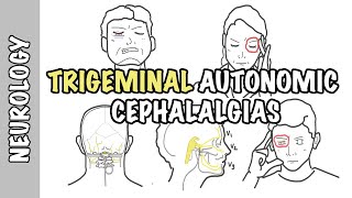 Severe headaches  Understanding Trigeminal Autonomic Cephalgias  types pathophysiology treatment [upl. by Regni]