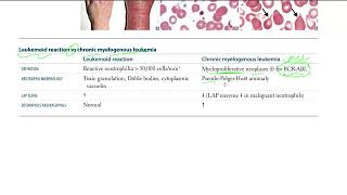 42 Leukemoid reaction vs chronic myelogenous leukemia [upl. by Aldas]