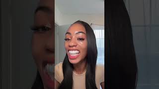 The best teeth whitening trays [upl. by Dewain]