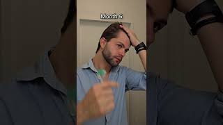 My 2Year Hair Growth Journey hair hairtransformation [upl. by Kazmirci863]