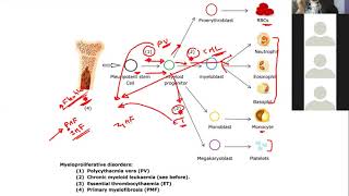 Hematology 11a  Myeloproliferative neoplasms [upl. by Trilby521]