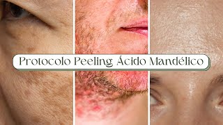 PROTOCOLO COMPLETO PEELING DE ÁCIDO MANDÉLICO [upl. by Thurlough264]