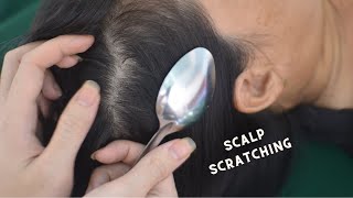 ASMR Sounds Of Scalp Scratching Fast And Aggressive Therapy Sounds For Reduce Headache [upl. by Franciskus]