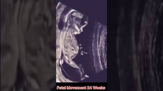 Fetal Movement 24 Weeks [upl. by Adnamar]