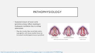 Common Perioperative Complications Keyword Review  Dr Green [upl. by Goodman620]