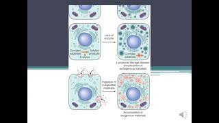 Parenchymal Stromal  Vascular Dystrophiesamp Mixed DystophiesCalcification pathology [upl. by Quinlan]