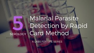 Malarial Parasite Detection by Rapid Card Method [upl. by Minda]