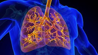 Treatment for Tracheobronchomalacia TBM [upl. by Ordnaxela]