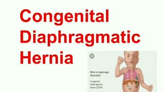 Congenital Diaphragmatic Hernia amp Hiatal Hernia [upl. by Amarette738]