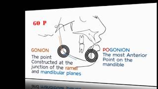 Cephalometrics Part II [upl. by Velasco161]