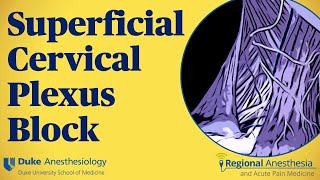 Superficial cervical plexus block [upl. by Bovill453]