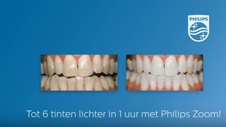 Philips Zoom Stap 4  Het resultaat – NL [upl. by Kellie]