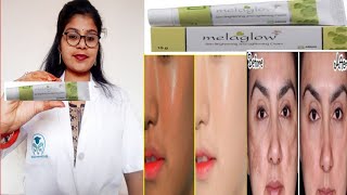 Best Skin Lightening Melaglow cream honest review  Melaglow skin cream benefits uses review inhindi [upl. by Adnamra]