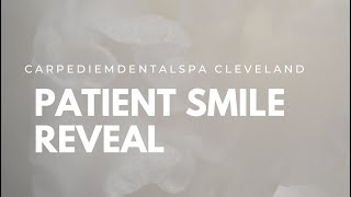 Our Patients Smile Reveal🤩 [upl. by Zetroc]