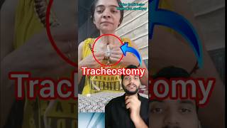 Tracheostomy shorts [upl. by Prior69]