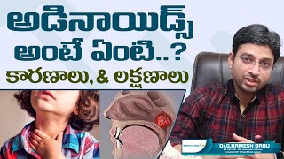 అడినాయిడ్స్ అంటే ఏంటి  Adenoids amp Adenoid Hypertrophy Causes  Dr Ramesh Babu ENT [upl. by Airottiv]