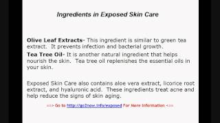 Exposed Skin Care Review [upl. by Freudberg95]