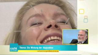 Akupunktur mit Dr med Horst Kief  Café am Morgen Folge 14 [upl. by Encrata]