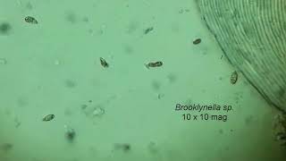 Aquaveterinarian Brooklynella microscopic ID [upl. by Karolina]