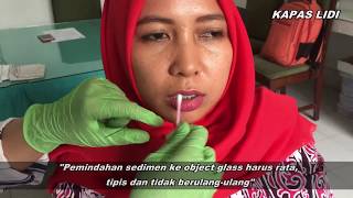 Exfoliative Cytology pada Rongga Mulut [upl. by Anwahsat]