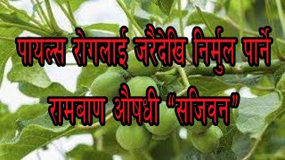 Treatment Of Piles In Nepali पायल्स रोगको जरैदेखि उपचार [upl. by Marla]