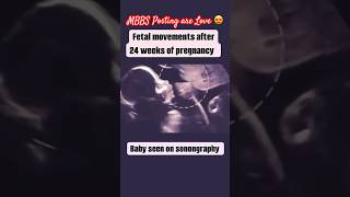 Baby Movement in Womb 👼🏻🐣 shorts viral neet [upl. by Atinauj]