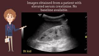 Increased renal cortical echogenicity on ultrasound is not always chronic kidney disease I POCUS [upl. by Rosane]