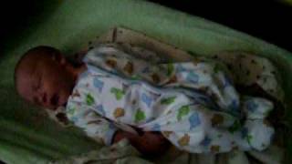 Benign Neonatal Sleep Myoclonus [upl. by Tessy]