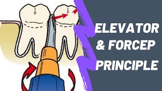 Principles of Elevator Forcep in Uncomplicated Exodontia Lever Wedge Wheel amp Axle Apexo Cryer [upl. by Raskind903]