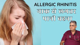 allergic rhinitis DO YOU Suffer From ALLERGIC RHINITIS Runny nose [upl. by Narra]