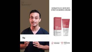 How To Get Rid of Stretch Marks Fast Bye Bye Stretch Marks Cream [upl. by Linc]